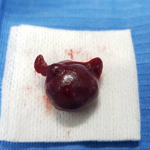เจองานหิน! สัตวเเพทย์เล่าประสบการณ์ ผ่าตัดหนูแฮมสเตอร์ หลังพบเนื้องอกในช่องท้อง