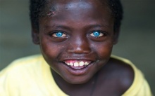 เปิดชีวิตเด็กชายแอฟริกัน เกิดมาพร้อม “ตาสีฟ้า” แต่ชีวิตไม่ได้สวยงามเหมือน “นัยน์ตา” !!