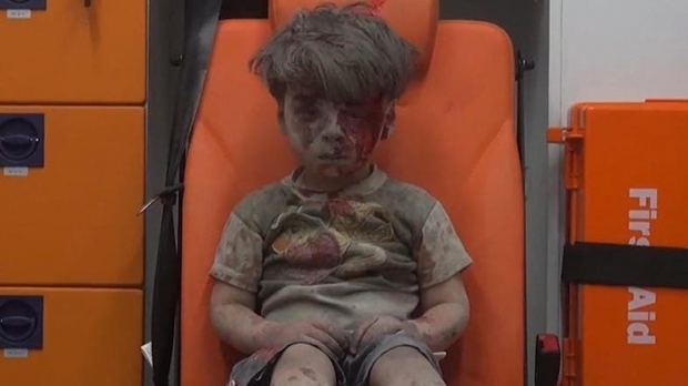 ยังจำหนูน้อยคนนี้ได้ไหม นี่คือภาพชีวิตปัจจุบันของเด็กผู้ได้รับผลกระทบจากสงครามซีเรีย