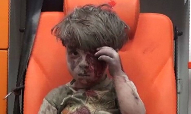 ยังจำหนูน้อยคนนี้ได้ไหม นี่คือภาพชีวิตปัจจุบันของเด็กผู้ได้รับผลกระทบจากสงครามซีเรีย