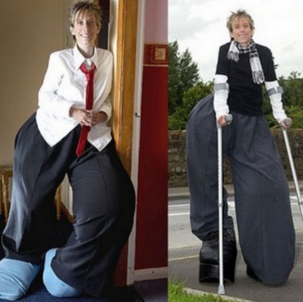 ตะลึงสุดๆ!! หญิงที่ “ขาใหญ่ที่สุดในโลก” เมื่อขนาดเห็นรองเท้าถึงกับผงะ!! ใหญ่ 3 เท่าของคนปกติ