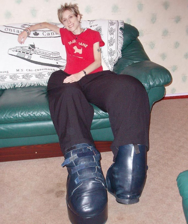 ตะลึงสุดๆ!! หญิงที่ “ขาใหญ่ที่สุดในโลก” เมื่อขนาดเห็นรองเท้าถึงกับผงะ!! ใหญ่ 3 เท่าของคนปกติ
