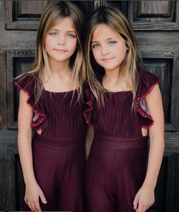 เปิดหน้า พ่อแม่และพี่ชาย ของ 2 สาวน้อยที่ถูกยกให้เป็นคู่แฝดสวยที่สุดในโลก!