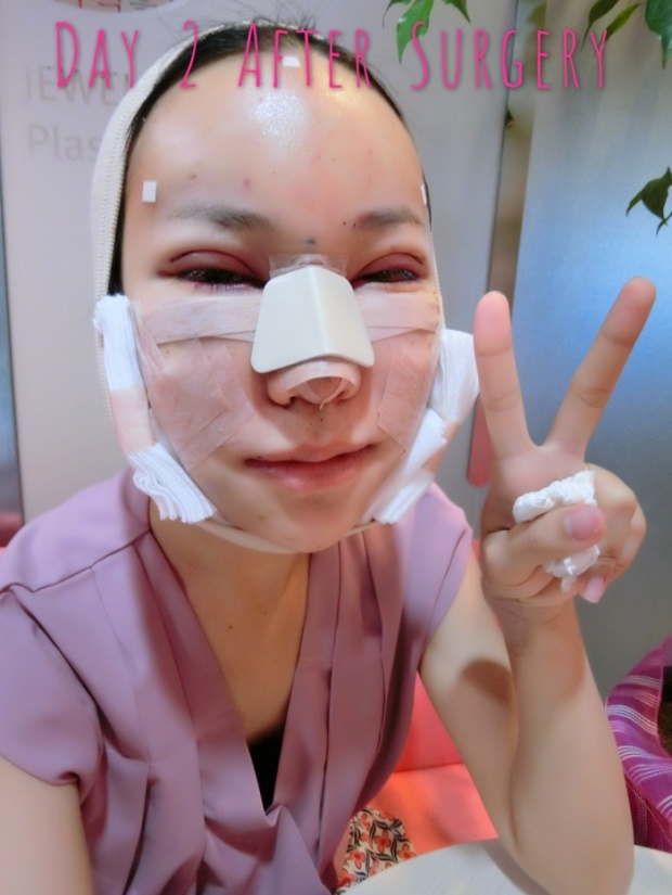 แชร์สนั่น!! สาวไทย”ลงทุนรีวิว”ทำศัลยกรรมที่เกาหลี..ตั้งแต่วันแรกจนวันสุดท้าย!! (ภาพโหด)