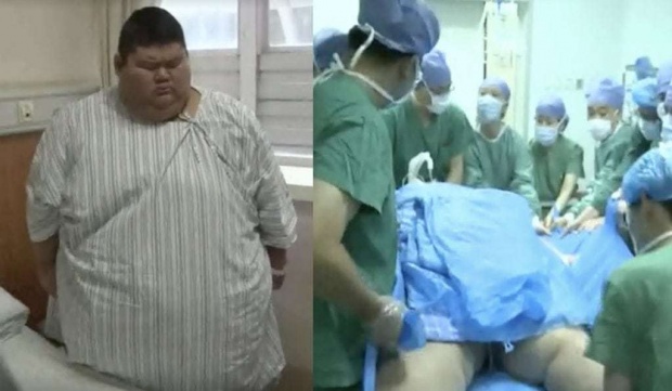 หนุ่มวัย 19 ปี หนัก 334 กิโลกรัม เข้าผ่าตัดลดความอ้วน เพราะฝันอยากเป็นเทรนเนอร์!!