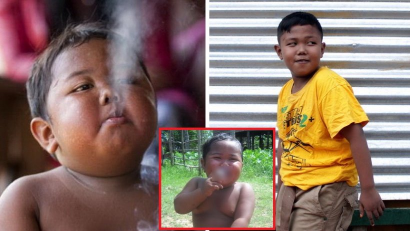เปิดภาพล่าสุด เด็กอินโดที่สูบบุหรี่วันละ 40 มวน ตอนนี้เป็นหนุ่มเเล้ว