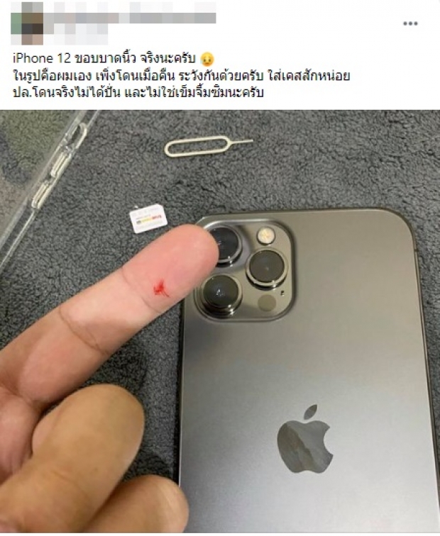 หนุ่มรีวิว iPhone 12 เครื่องคมกริบ จนโดนบาดนิ้วเลือดซิบ 