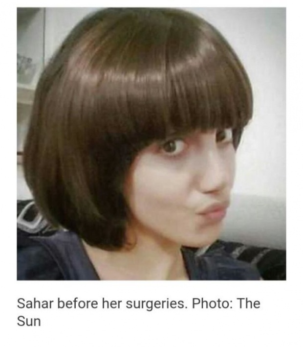 เปิดภาพก่อนศัลยกรรม 50 ครั้ง!! สาวอิหร่านหน้าเหมือน “แองเจลีนา โจลี” น่ารักสุดๆ