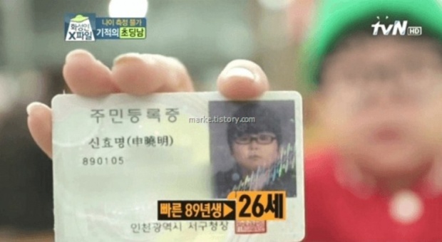 หนุ่มเกาหลีวัย 29 ป่วยโรคหายาก!! ร่างกาย หน้าตาและน้ำเสียงอ่อนเยาว์ ราวกับเด็กวัยประถม!!