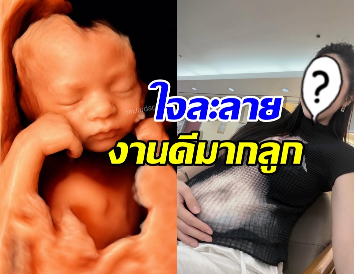 สาวคนดังเผยโฉมเบบี๋ในท้อง หน้าฟ้าประทานมาก