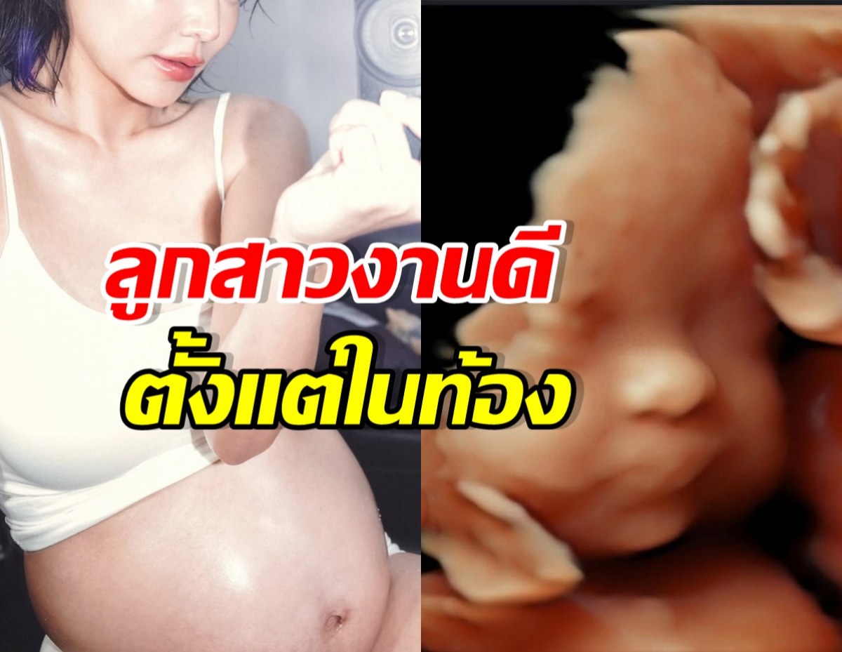คุณแม่คนสวย เผยภาพลูกสาวในท้อง DNA พรีเมี่ยมสุดๆ