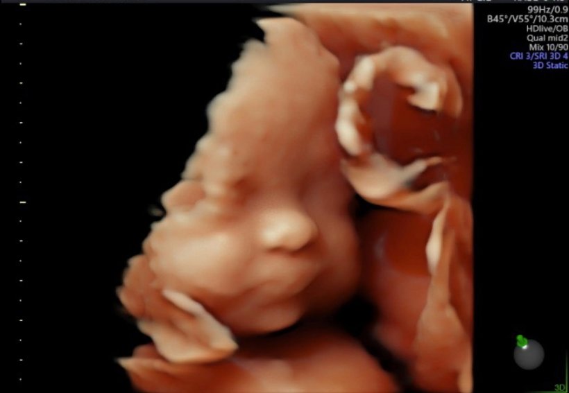 คุณแม่คนสวย เผยภาพลูกสาวในท้อง DNA พรีเมี่ยมสุดๆ