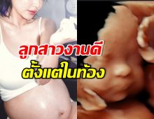 คุณแม่คนสวย เผยภาพลูกสาวในท้อง DNA พรีเมี่ยมสุดๆ