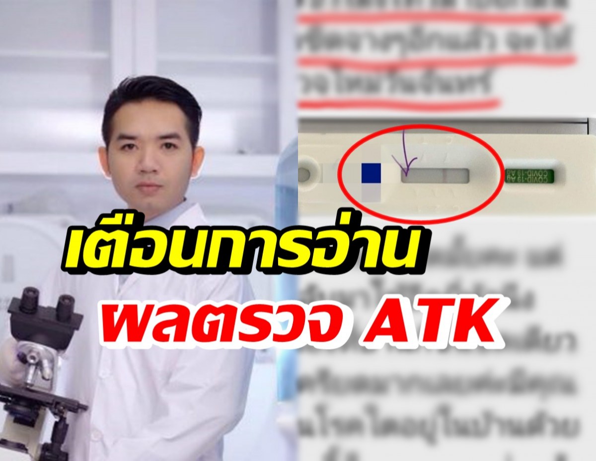 หมอแล็บแพนด้า ย้ำการอ่านผลตรวจATK เพื่อเลี่ยงผลบวกปลอม