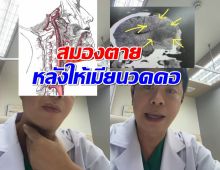 หมอ ยกเคส ผู้ป่วยตื่นเช้ามาแขนขาอ่อนแรง พบสมองตาย หลังให้เมียนวดคอ