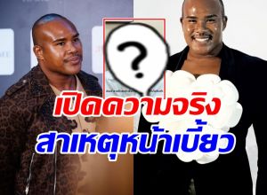 รัศมีแข เปิดภาพล่าสุด ใบหน้าเบี้ยว จนอดเป็นห่วงไม่ได้