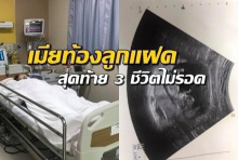 สุดเศร้า ! หนุ่มโพสต์เล่าประสบการณ์เมียท้องลูกแฝด แต่สุดท้าย 3 ชีวิตไม่รอด