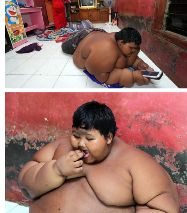  ยังจำได้ไหม? เด็ก12 อ้วนที่สุดในโลก ล่าสุดลดน้ำหนักได้สมใจ นี่คือภาพล่าสุด!!(คลิป)