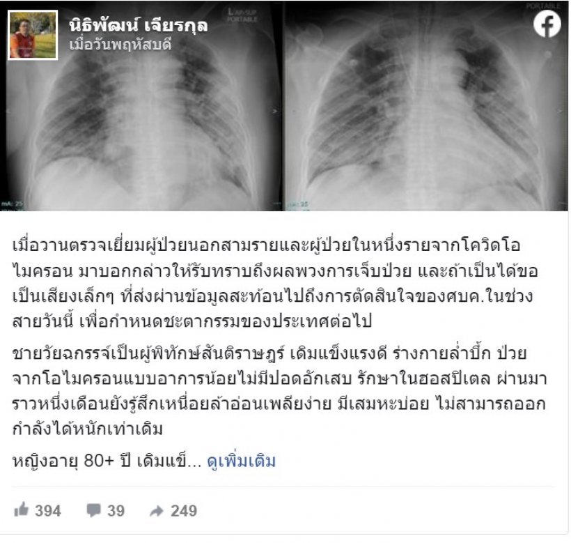 หลังติดโอมิครอน หายแล้วแต่ร่างกายไม่เหมือนเดิม