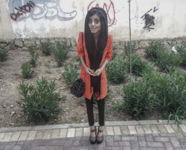 สาวอิหร่านคลั่ง แอนเจลิน่าโจลี ลงทุนผ่าตัดกว่า 50 ครั้ง เพราะอยากสวยเหมือนเธอ