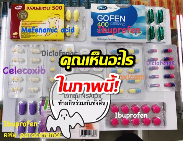 เภสัชให้ความรู้! ยากลุ่ม NSAIDs คืออะไร - ห้ามกินร่วมกันไม่งั้นอาจเสียชีวิต