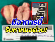 สาวโพสต์อุทาหรณ์! เนื้องอกในมดลูก-ช๊อคโกแลตซีสท์ เหมือนมีเด็กในท้อง!