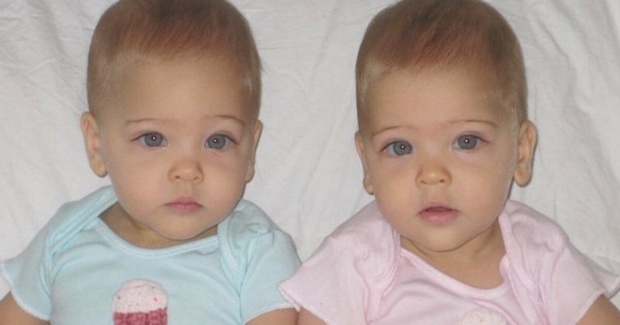 ทารกแฝดเพศหญิง โตขึ้นมาถูกยกให้เป็นแฝดที่สวยที่สุดในโลก! แถมยังได้เซ็นสัญญาเป็นนางแบบแล้ว