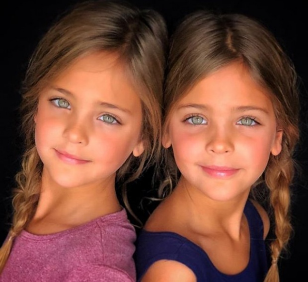 ทารกแฝดเพศหญิง โตขึ้นมาถูกยกให้เป็นแฝดที่สวยที่สุดในโลก! แถมยังได้เซ็นสัญญาเป็นนางแบบแล้ว
