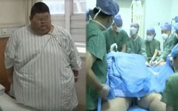 หนุ่มวัย 19 ปี หนัก 334 กิโลกรัม เข้าผ่าตัดลดความอ้วน เพราะฝันอยากเป็นเทรนเนอร์!!
