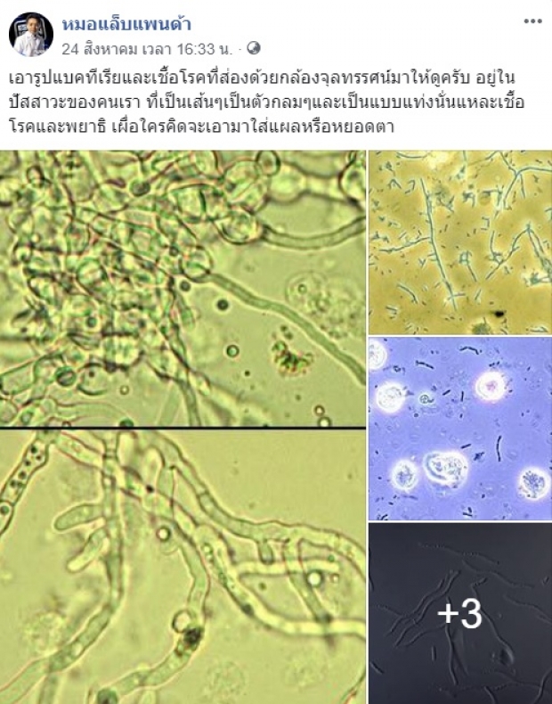 หมอแล็บแพนด้า เผยภาพสุดยี้! แบคทีเรียและเชื้อโรค ในปัสสาวะของคน