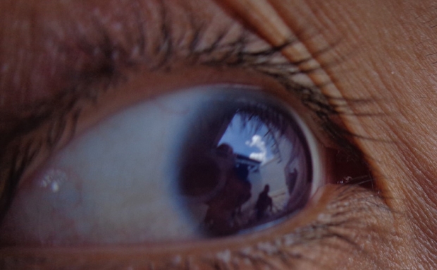 คนไข้โควิด-19 ตาเรืองแสงเปลี่ยนเป็นสีม่วง แพทย์เผยสาเหตุ