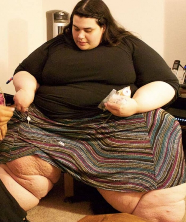 ขยี้ตาพัง! สาวไซส์ยักษ์ อ้วนจนเดินไม่ได้ ตัดสินใจผ่าตัดลดน้ำหนัก และนี่คือความเปลี่ยนแปลงที่เกิดขึ้น!