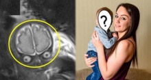 ภาพถ่ายทารกในท้องคล้าย มนุษย์ต่างดาว จนเธอกลัวลูกจะหน้าตาประหลาด กระทั่งคลอดออกมา