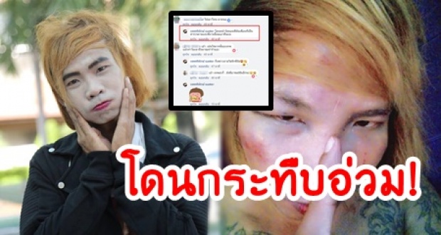 “เทพพิทักษ์” โดนกระทืบอ่วม หน้าตาถลอกปอกเปิก ลั่น ”ผมเอาคืนแน่นอน”!?