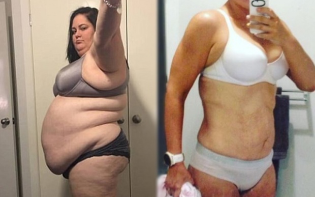 ขยี้ตาพัง! สาวอ้วนขี้โรค ลุกขึ้นมาเปลี่ยนตัวเอง หลังพบว่าจะมีชีวิตอยู่ได้ไม่นาน และนี่คือภาพล่าสุด!